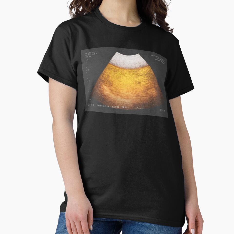 Beer Ultrasound by Soceitiz